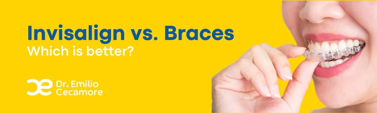 Invisalign and braces: which is better?