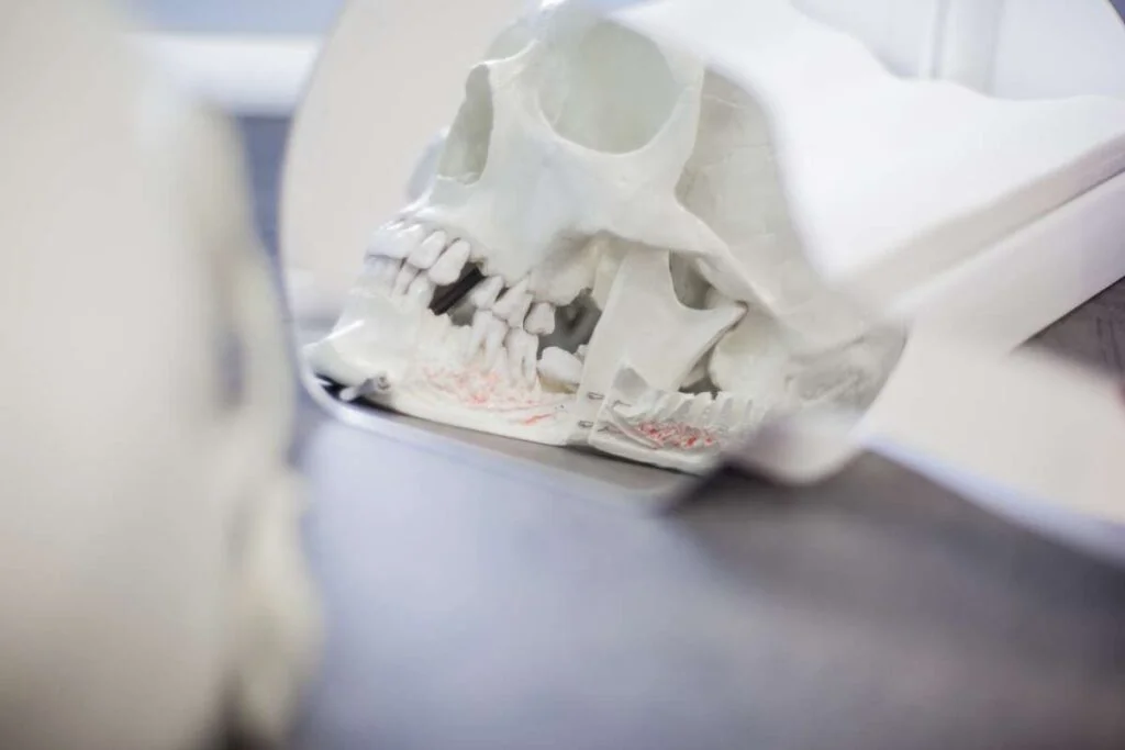 Dental conservative treatment